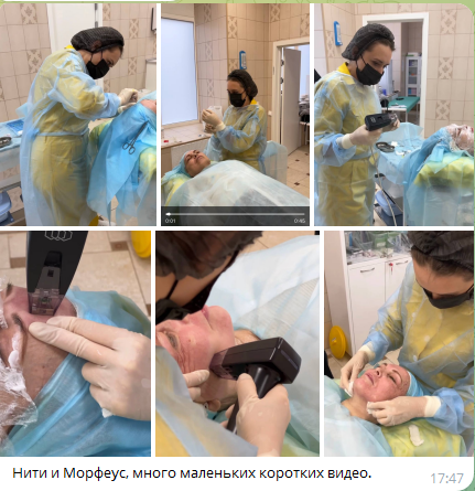 Нити и Морфеус — до и после